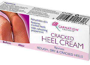 SRP:£3.20 CARNATION - CRACKED HEEL CREAM (CAR 153)